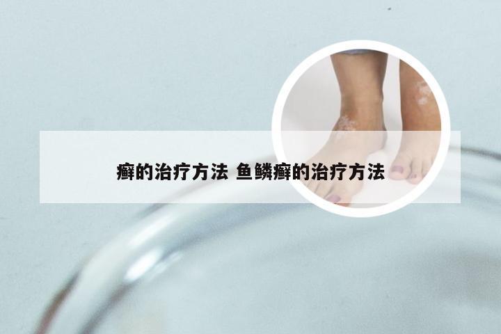 癣的治疗方法 鱼鳞癣的治疗方法