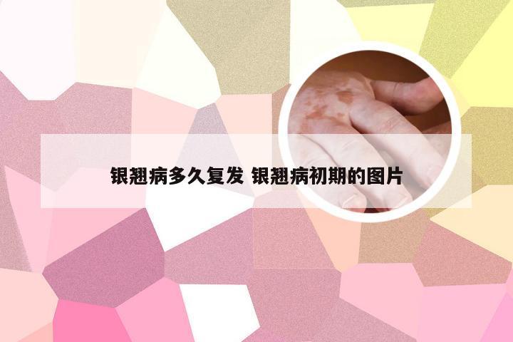 银翘病多久复发 银翘病初期的图片