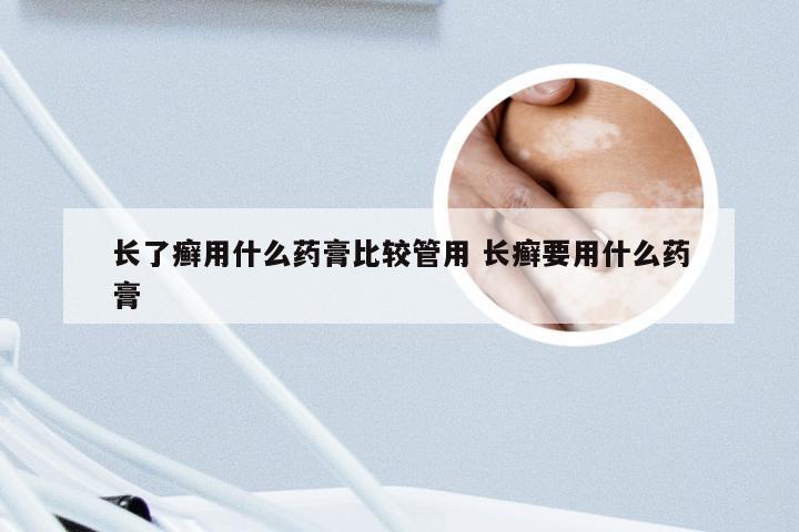 长了癣用什么药膏比较管用 长癣要用什么药膏