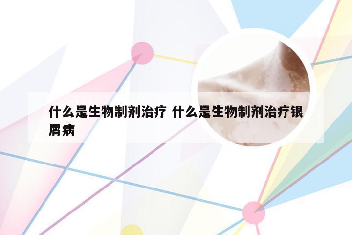 什么是生物制剂治疗 什么是生物制剂治疗银屑病