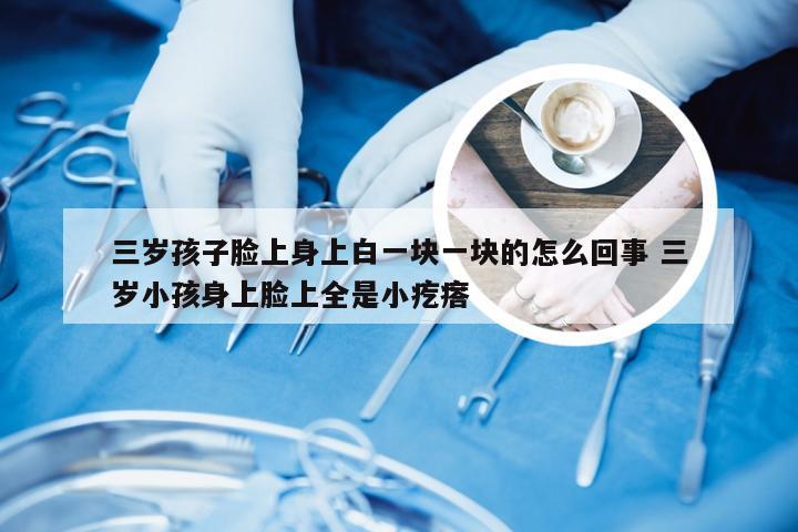 三岁孩子脸上身上白一块一块的怎么回事 三岁小孩身上脸上全是小疙瘩
