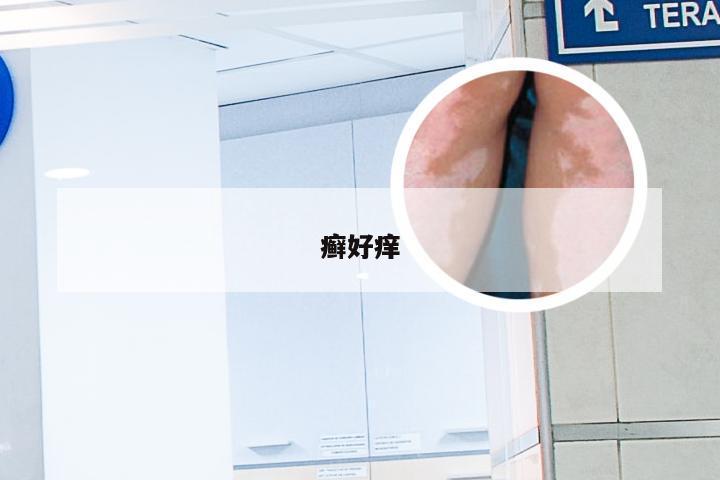 癣好痒
