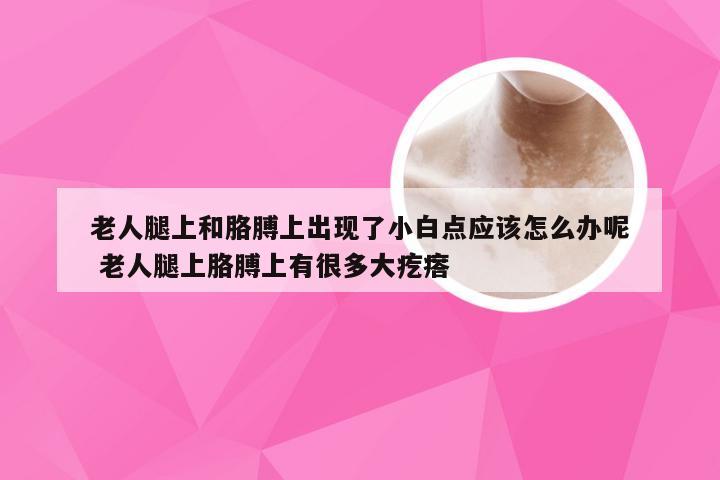 老人腿上和胳膊上出现了小白点应该怎么办呢 老人腿上胳膊上有很多大疙瘩