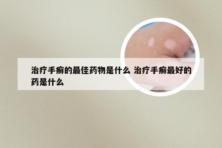 治疗手癣的最佳药物是什么 治疗手癣最好的药是什么