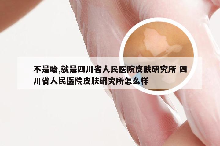 不是哈,就是四川省人民医院皮肤研究所 四川省人民医院皮肤研究所怎么样
