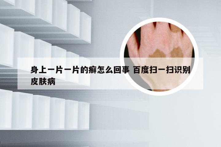 身上一片一片的癣怎么回事 百度扫一扫识别皮肤病