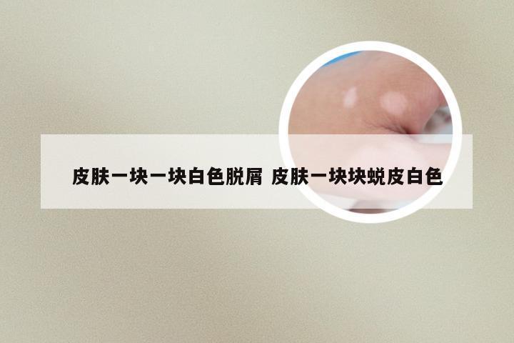 皮肤一块一块白色脱屑 皮肤一块块蜕皮白色