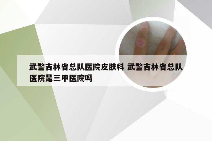 武警吉林省总队医院皮肤科 武警吉林省总队医院是三甲医院吗