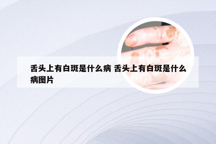 舌头上有白斑是什么病 舌头上有白斑是什么病图片