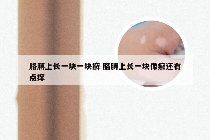 胳膊上长一块一块癣 胳膊上长一块像癣还有点痒