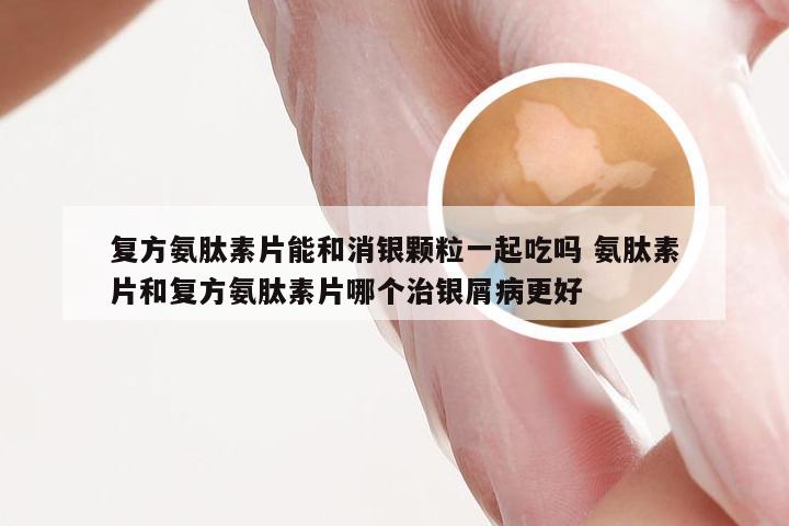 复方氨肽素片能和消银颗粒一起吃吗 氨肽素片和复方氨肽素片哪个治银屑病更好
