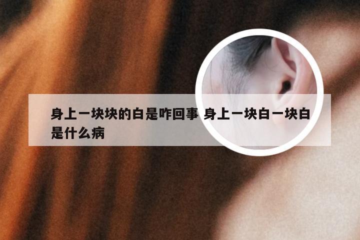 身上一块块的白是咋回事 身上一块白一块白是什么病