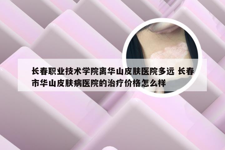 长春职业技术学院离华山皮肤医院多远 长春市华山皮肤病医院的治疗价格怎么样