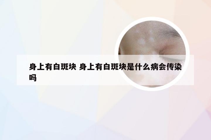 身上有白斑块 身上有白斑块是什么病会传染吗