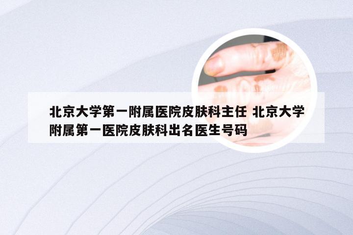 北京大学第一附属医院皮肤科主任 北京大学附属第一医院皮肤科出名医生号码