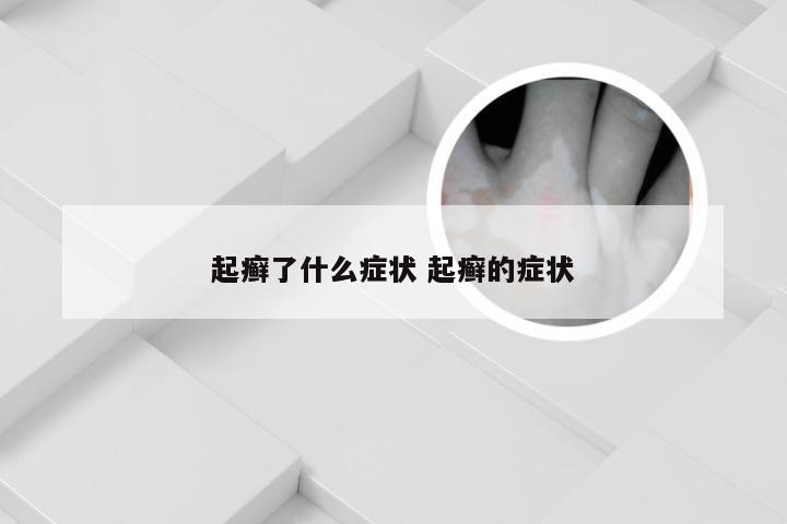 起癣了什么症状 起癣的症状