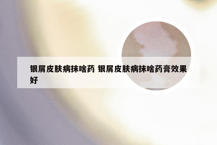 银屑皮肤病抹啥药 银屑皮肤病抹啥药膏效果好