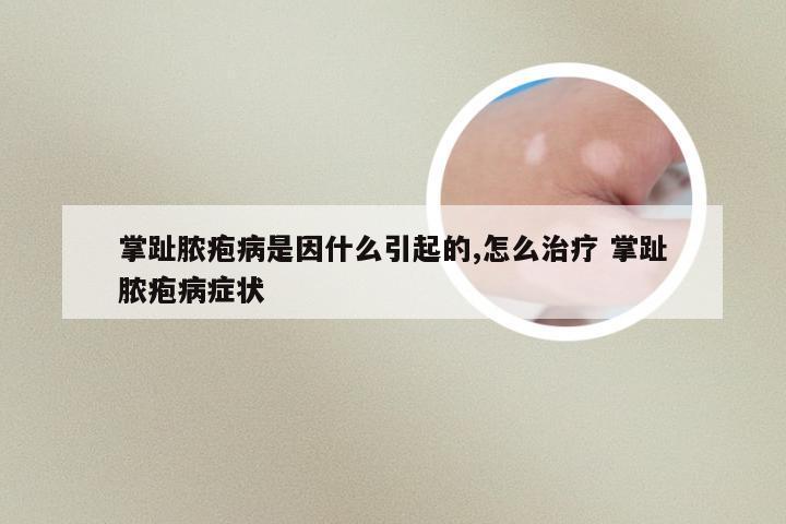 掌趾脓疱病是因什么引起的,怎么治疗 掌趾脓疱病症状
