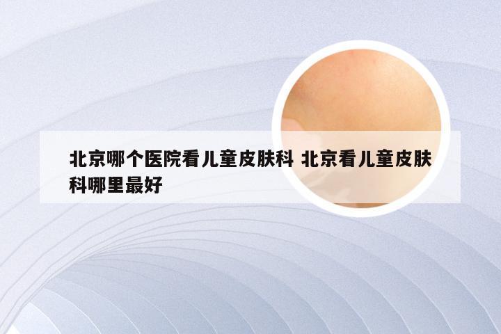 北京哪个医院看儿童皮肤科 北京看儿童皮肤科哪里最好