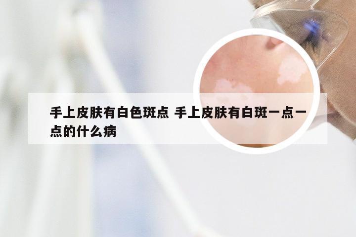 手上皮肤有白色斑点 手上皮肤有白斑一点一点的什么病