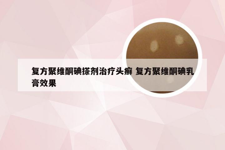 复方聚维酮碘搽剂治疗头癣 复方聚维酮碘乳膏效果