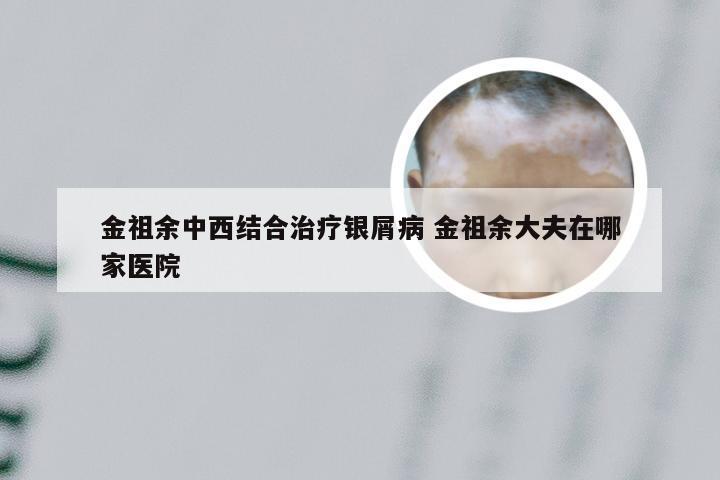 金祖余中西结合治疗银屑病 金祖余大夫在哪家医院