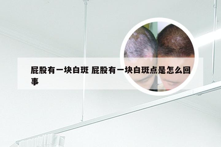 屁股有一块白斑 屁股有一块白斑点是怎么回事