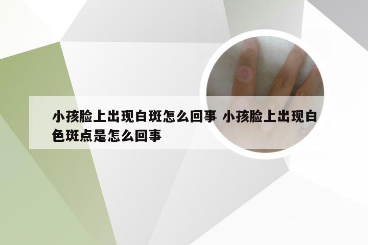 小孩脸上出现白斑怎么回事 小孩脸上出现白色斑点是怎么回事