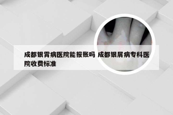 成都银霄病医院能报账吗 成都银屑病专科医院收费标准