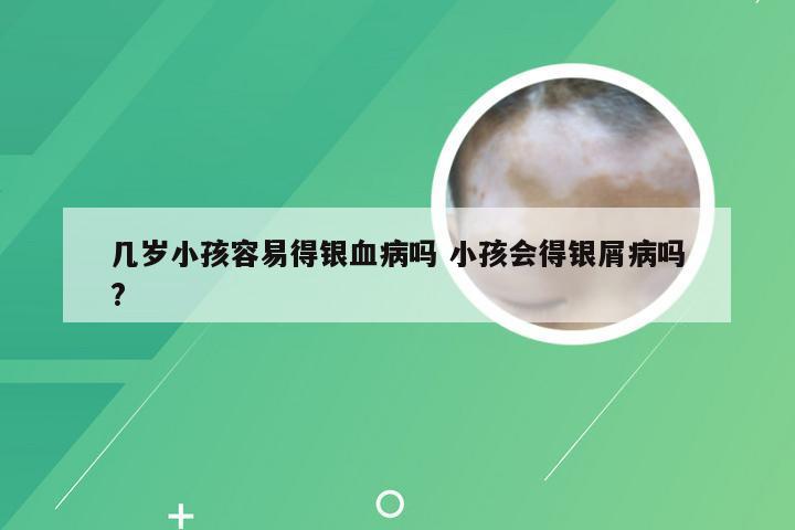 几岁小孩容易得银血病吗 小孩会得银屑病吗?