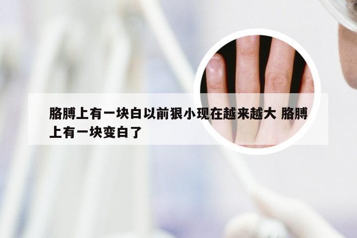 胳膊上有一块白以前狠小现在越来越大 胳膊上有一块变白了