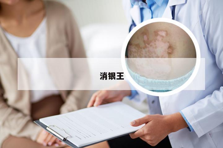 消银王