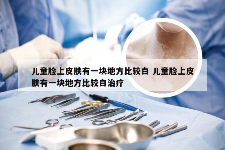儿童脸上皮肤有一块地方比较白 儿童脸上皮肤有一块地方比较白治疗
