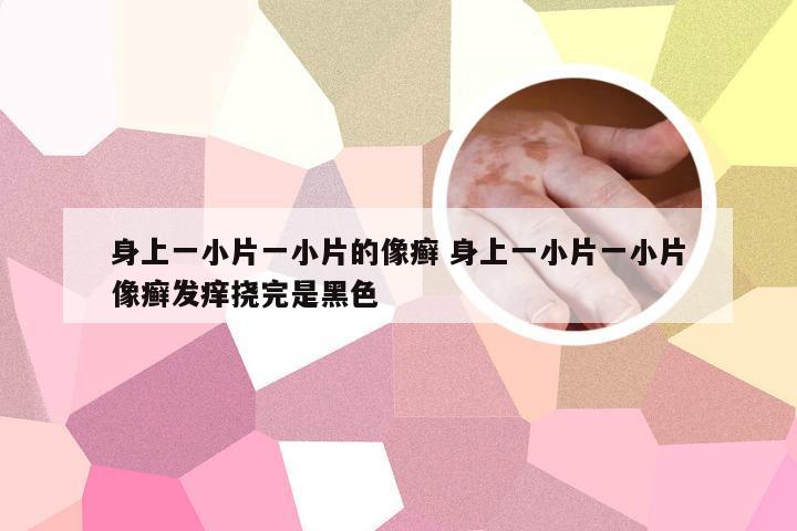 身上一小片一小片的像癣 身上一小片一小片像癣发痒挠完是黑色
