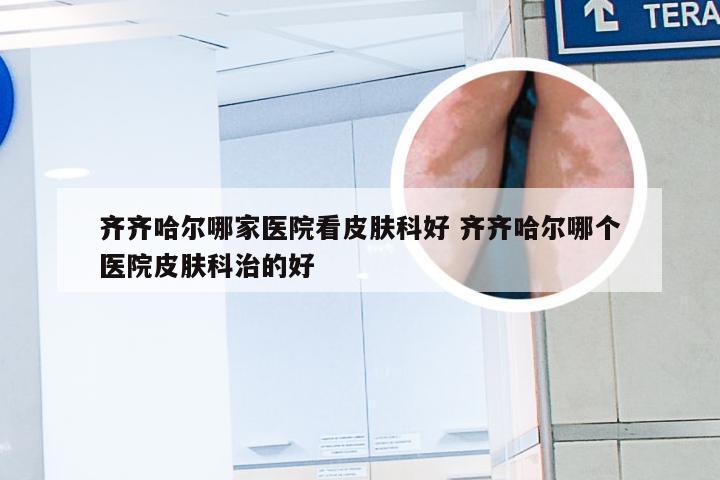 齐齐哈尔哪家医院看皮肤科好 齐齐哈尔哪个医院皮肤科治的好