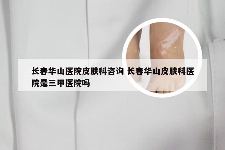 长春华山医院皮肤科咨询 长春华山皮肤科医院是三甲医院吗
