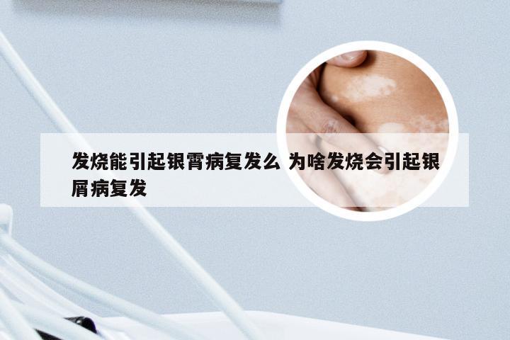 发烧能引起银霄病复发么 为啥发烧会引起银屑病复发