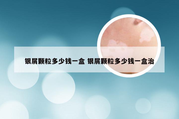 银屑颗粒多少钱一盒 银屑颗粒多少钱一盒治