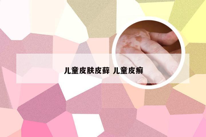 儿童皮肤皮藓 儿童皮癣