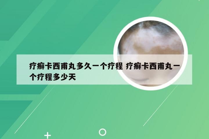 疗癣卡西甫丸多久一个疗程 疗癣卡西甫丸一个疗程多少天