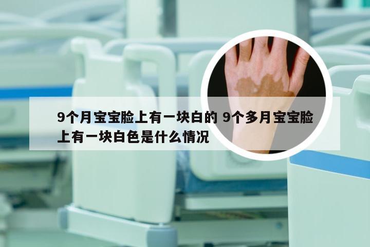 9个月宝宝脸上有一块白的 9个多月宝宝脸上有一块白色是什么情况