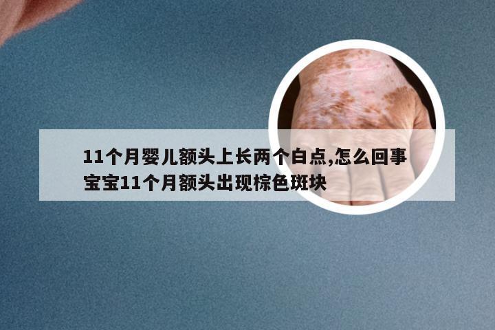 11个月婴儿额头上长两个白点,怎么回事 宝宝11个月额头出现棕色斑块