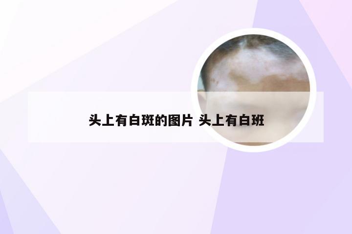 头上有白斑的图片 头上有白班