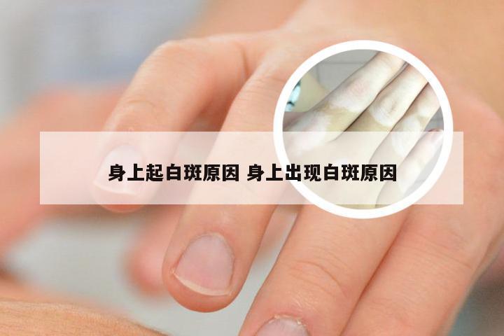 身上起白斑原因 身上出现白斑原因