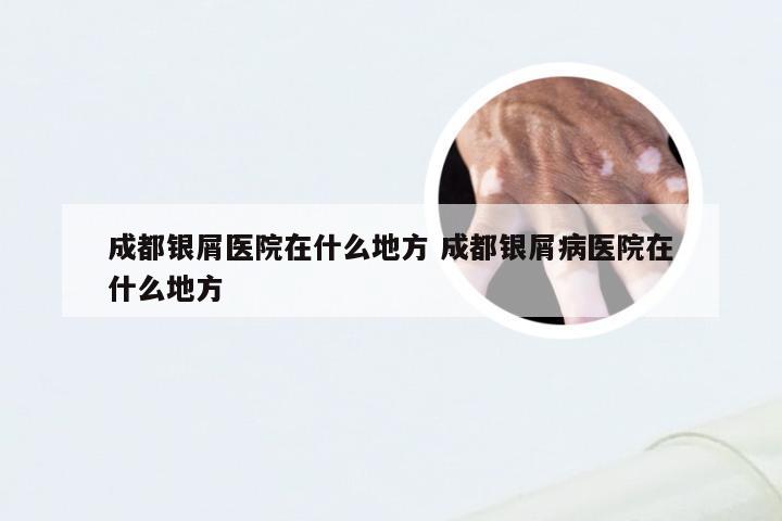 成都银屑医院在什么地方 成都银屑病医院在什么地方