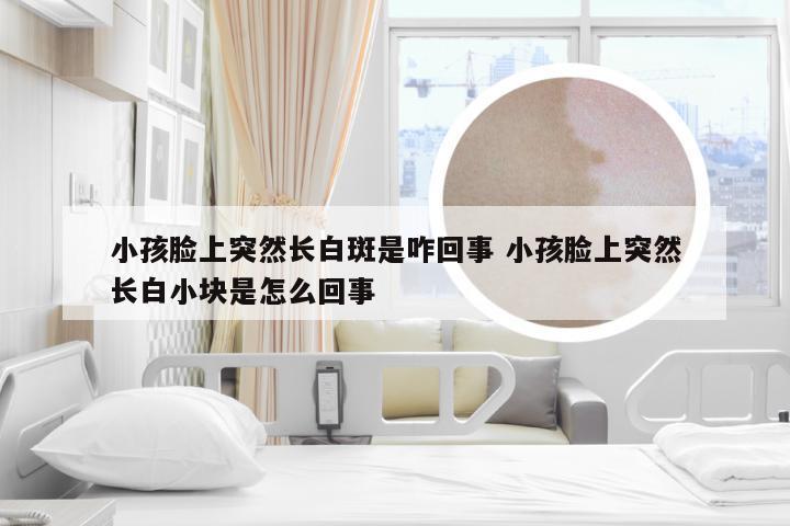 小孩脸上突然长白斑是咋回事 小孩脸上突然长白小块是怎么回事