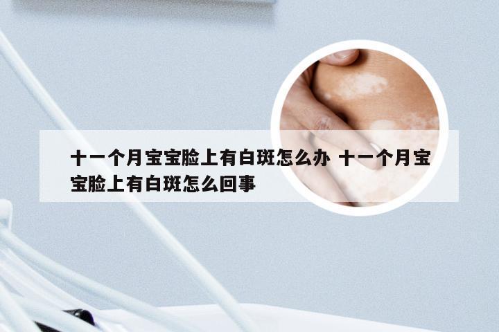 十一个月宝宝脸上有白斑怎么办 十一个月宝宝脸上有白斑怎么回事