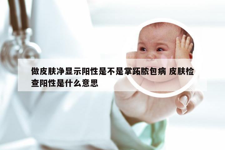 做皮肤净显示阳性是不是掌跖脓包病 皮肤检查阳性是什么意思