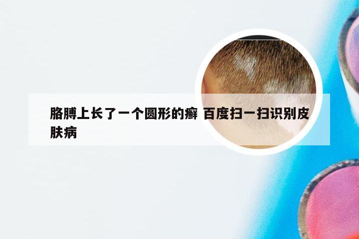 胳膊上长了一个圆形的癣 百度扫一扫识别皮肤病