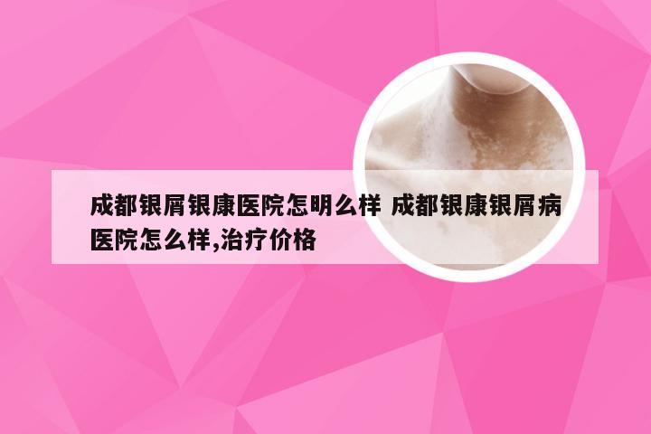 成都银屑银康医院怎明么样 成都银康银屑病医院怎么样,治疗价格